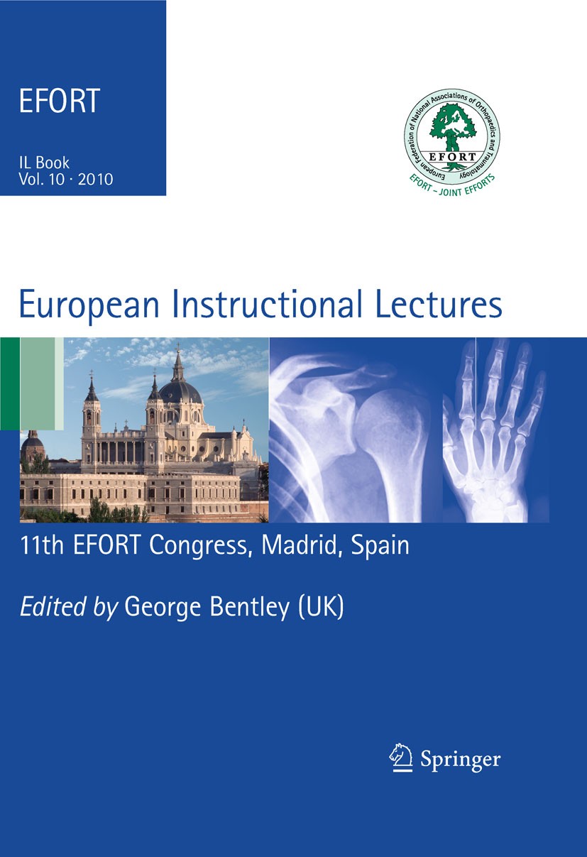 Titlebook: European Instructional Lectures; Volume 10, 2010; 11t George Bentley Book 2010 The Editor(s) (if applicable) and The Author(s), under exclu Titlebook: European Instructional Lectures; Volume 10, 2010; 11t George Bentley Book 2010 The Editor(s) (if applicable) and The Author(s), under exclu