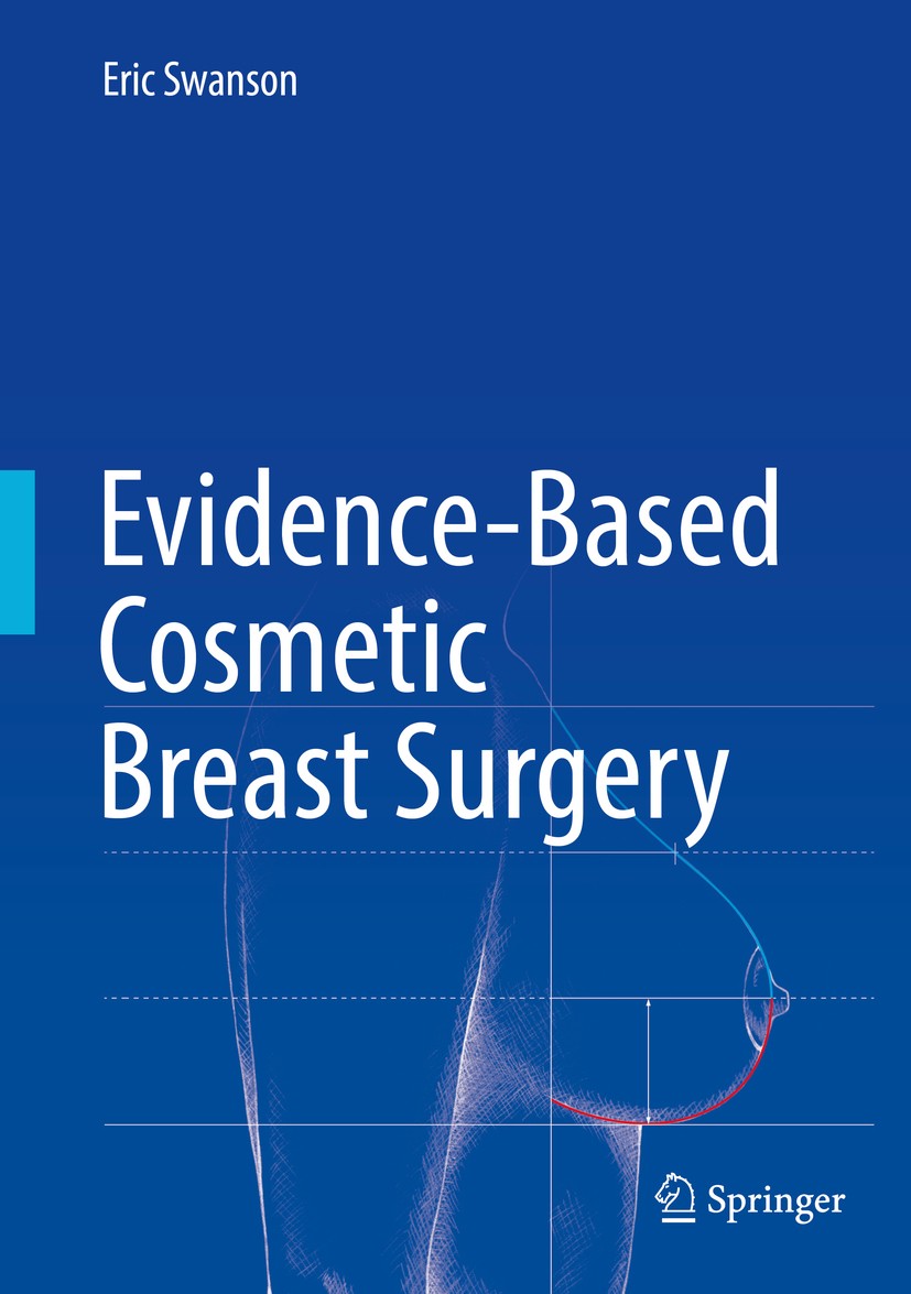 Titlebook: Evidence-Based Cosmetic Breast Surgery; Eric Swanson Book 2017 Springer International Publishing AG 2017 cosmetic surgery.plastic surgery. Titlebook: Evidence-Based Cosmetic Breast Surgery; Eric Swanson Book 2017 Springer International Publishing AG 2017 cosmetic surgery.plastic surgery.