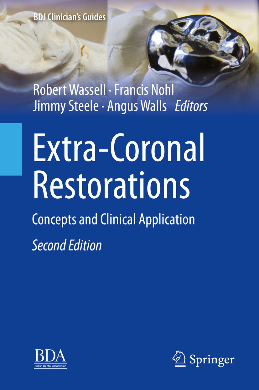 Titlebook: Extra-Coronal Restorations; Concepts and Clinica Robert Wassell,Francis Nohl,Angus Walls Book 2019Latest edition Springer International Pub Titlebook: Extra-Coronal Restorations; Concepts and Clinica Robert Wassell,Francis Nohl,Angus Walls Book 2019Latest edition Springer International Pub