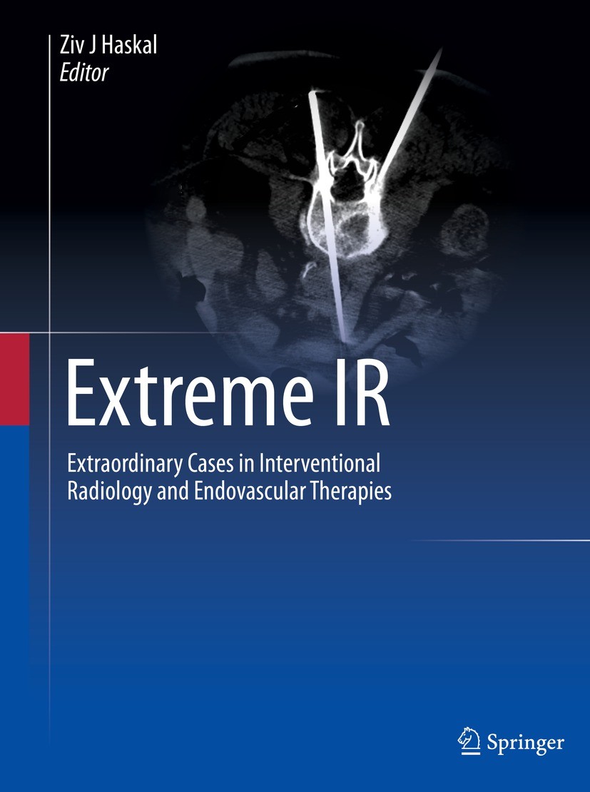 Titlebook: Extreme IR; Extraordinary Cases Ziv J Haskal Book 2023 The Editor(s) (if applicable) and The Author(s), under exclusive license to Springe Titlebook: Extreme IR; Extraordinary Cases Ziv J Haskal Book 2023 The Editor(s) (if applicable) and The Author(s), under exclusive license to Springe