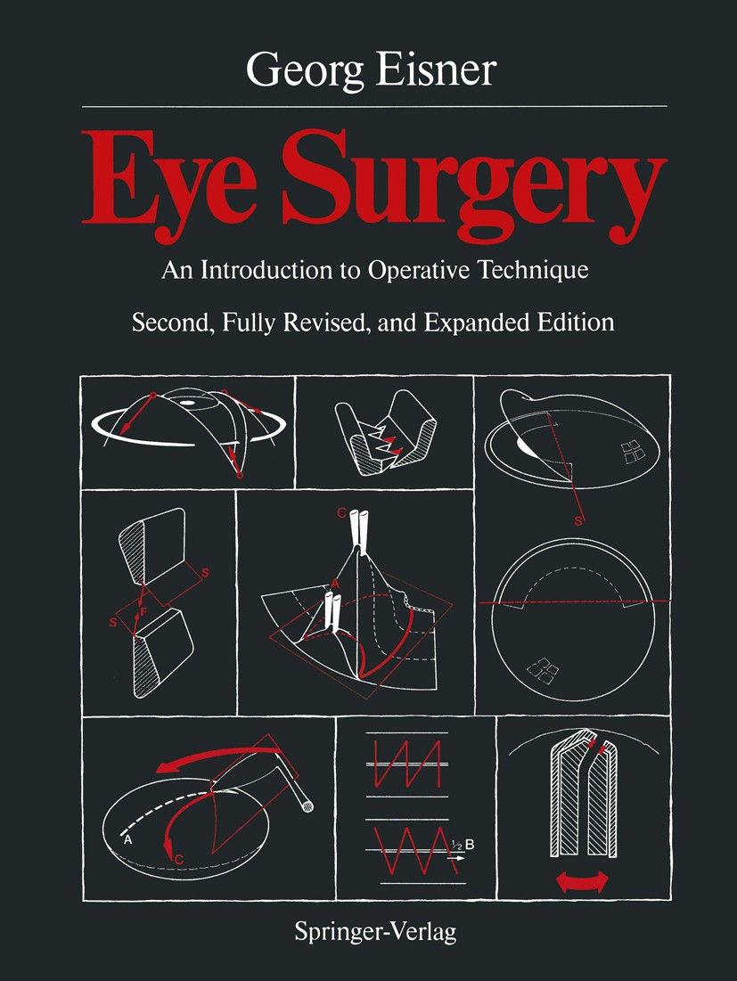 Titlebook: Eye Surgery; An Introduction to O Georg Eisner Book 1990Latest edition Springer-Verlag Berlin Heidelberg 1990 Augenchirurgie.Eye.Intraokula Titlebook: Eye Surgery; An Introduction to O Georg Eisner Book 1990Latest edition Springer-Verlag Berlin Heidelberg 1990 Augenchirurgie.Eye.Intraokula