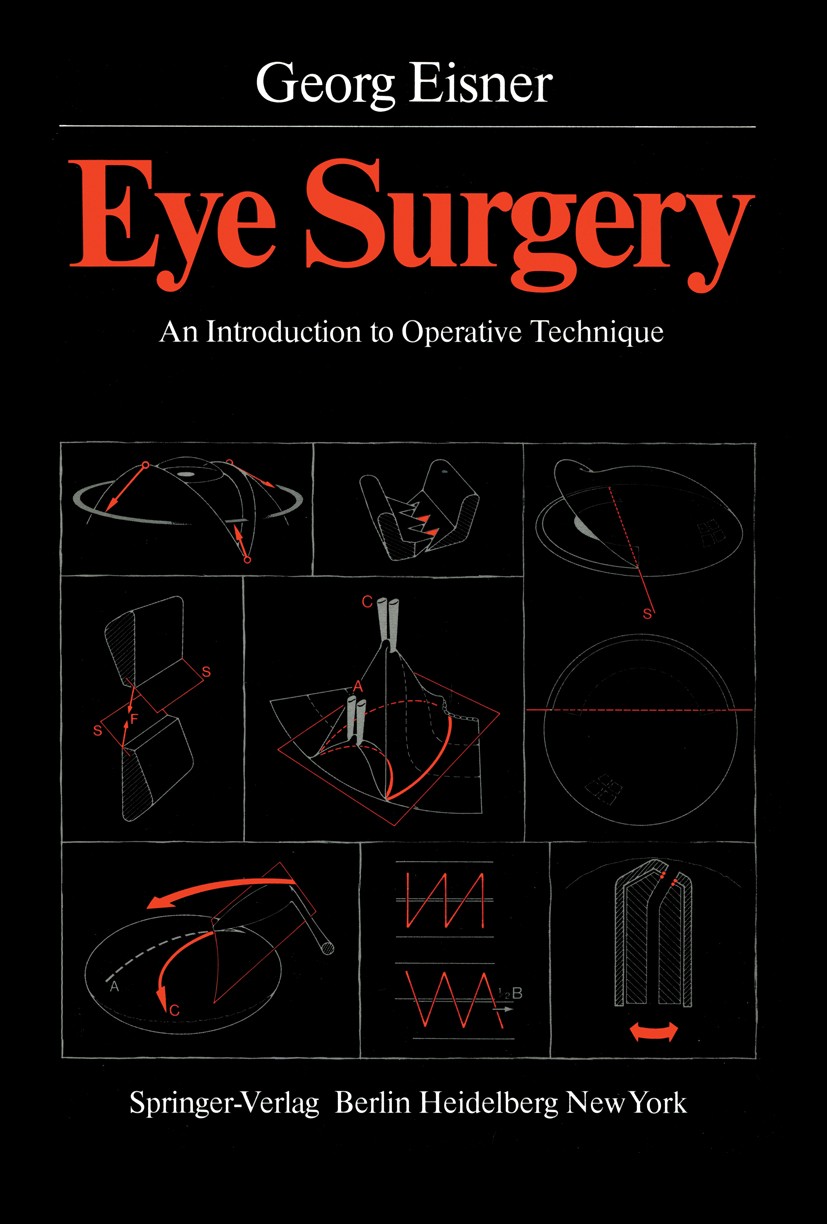 Titlebook: Eye Surgery; An Introduction to O Georg Eisner Book 19801st edition Springer-Verlag Berlin Heidelberg 1980 Augenchirurgie.Intraokulare Chir Titlebook: Eye Surgery; An Introduction to O Georg Eisner Book 19801st edition Springer-Verlag Berlin Heidelberg 1980 Augenchirurgie.Intraokulare Chir