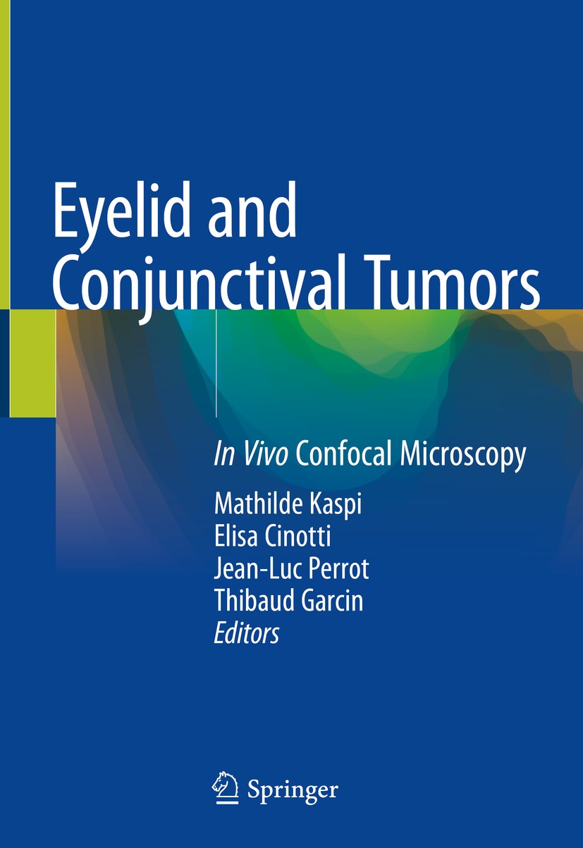 Titlebook: Eyelid and Conjunctival Tumors; In Vivo Confocal Mic Mathilde Kaspi,Elisa Cinotti,Thibaud Garcin Book 2020 Springer Nature Switzerland AG 2 Titlebook: Eyelid and Conjunctival Tumors; In Vivo Confocal Mic Mathilde Kaspi,Elisa Cinotti,Thibaud Garcin Book 2020 Springer Nature Switzerland AG 2