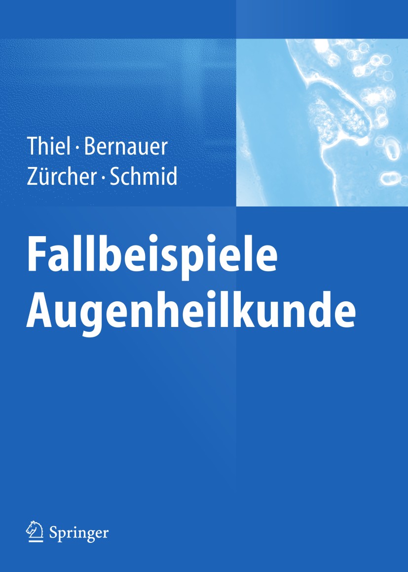 Titlebook: Fallbeispiele Augenheilkunde; Michael A. Thiel,Wolfgang Bernauer,Martin K. Schmi Book 2013 Springer-Verlag Berlin Heidelberg 2013 Titlebook: Fallbeispiele Augenheilkunde; Michael A. Thiel,Wolfgang Bernauer,Martin K. Schmi Book 2013 Springer-Verlag Berlin Heidelberg 2013