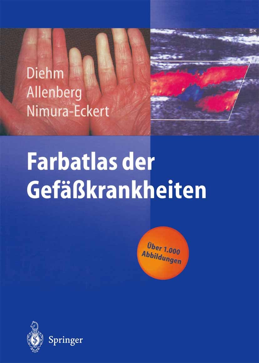 Titlebook: Farbatlas der Gefäßkrankheiten; Curt Diehm,Jens-Rainer Allenberg,Keiko Nimura-Ecke Book 1999 Springer-Verlag Berlin Heidelberg 1999 Angiol Titlebook: Farbatlas der Gefäßkrankheiten; Curt Diehm,Jens-Rainer Allenberg,Keiko Nimura-Ecke Book 1999 Springer-Verlag Berlin Heidelberg 1999 Angiol