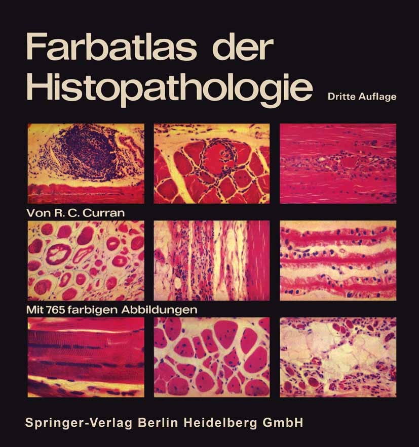 Titlebook: Farbatlas der Histopathologie; R. C. Curran Book 19753rd edition Springer-Verlag Berlin Heidelberg 1975 Gewebe.Histologie.Histopathologie. Titlebook: Farbatlas der Histopathologie; R. C. Curran Book 19753rd edition Springer-Verlag Berlin Heidelberg 1975 Gewebe.Histologie.Histopathologie.
