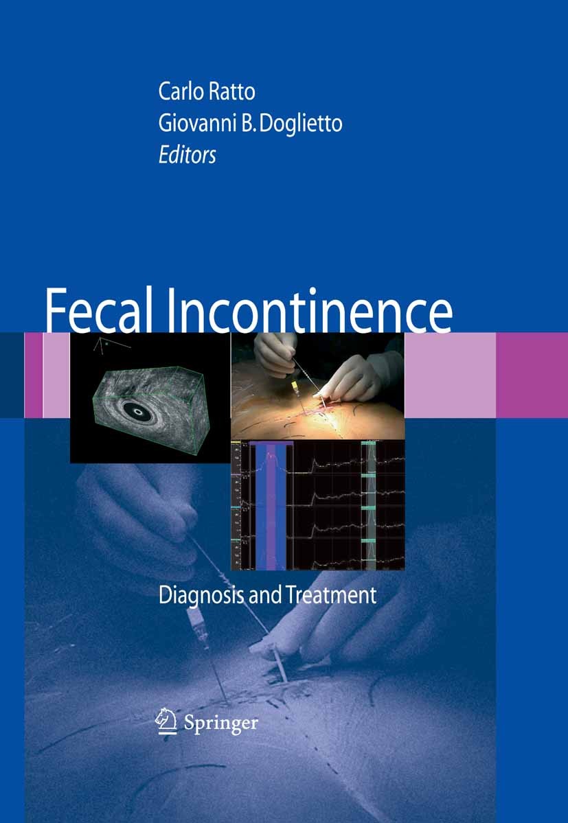 Titlebook: Fecal Incontinence; Diagnosis and Treatm Carlo Ratto,Giovanni B. Doglietto,Giovanni Romano Book 2007 Springer-Verlag Milan 2007 Fecal incon Titlebook: Fecal Incontinence; Diagnosis and Treatm Carlo Ratto,Giovanni B. Doglietto,Giovanni Romano Book 2007 Springer-Verlag Milan 2007 Fecal incon