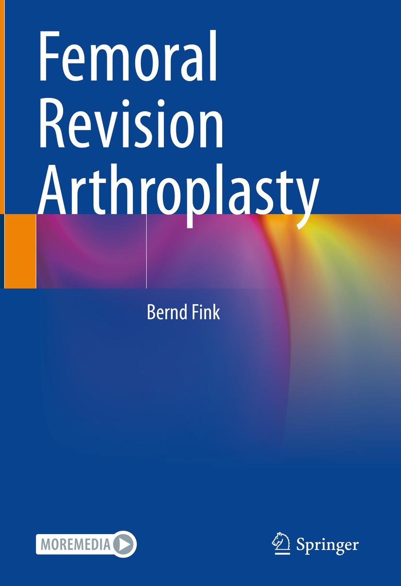 Titlebook: Femoral Revision Arthroplasty; Bernd Fink Book 2022 The Editor(s) (if applicable) and The Author(s), under exclusive license to Springer N Titlebook: Femoral Revision Arthroplasty; Bernd Fink Book 2022 The Editor(s) (if applicable) and The Author(s), under exclusive license to Springer N