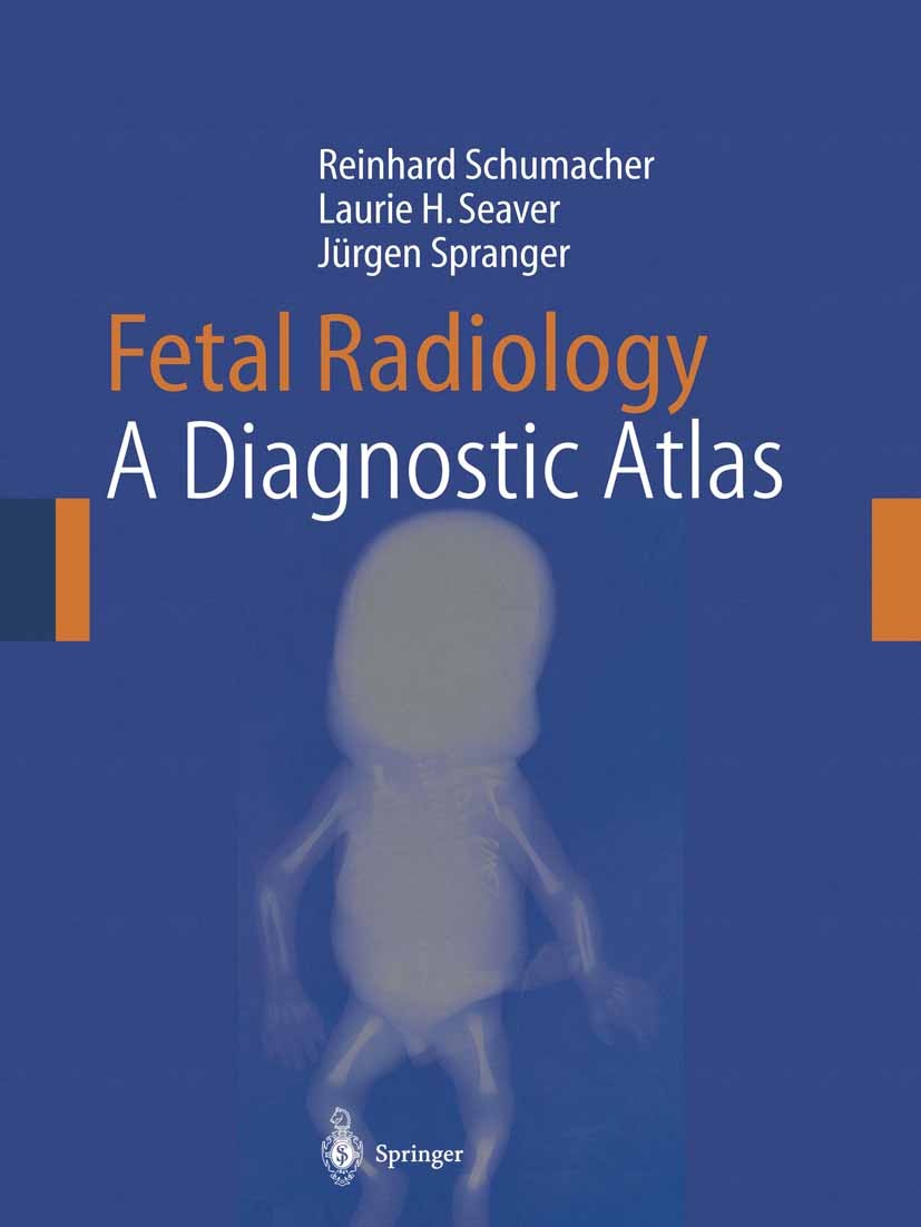 Titlebook: Fetal Radiology; A Diagnostic Atlas Reinhard Schumacher,Laurie H. Seaver,Jürgen Sprang Book 20041st edition Springer-Verlag Berlin Heidelbe Titlebook: Fetal Radiology; A Diagnostic Atlas Reinhard Schumacher,Laurie H. Seaver,Jürgen Sprang Book 20041st edition Springer-Verlag Berlin Heidelbe