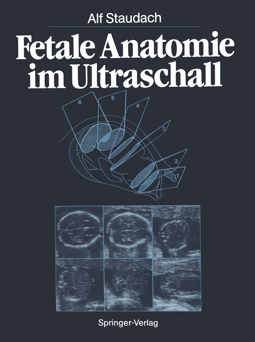 Titlebook: Fetale Anatomie im Ultraschall; Alf Staudach Book 1986 Springer-Verlag Berlin Heidelberg 1986 Abdomen.Anatomie.Auge.Beziehungen.Diagnostik Titlebook: Fetale Anatomie im Ultraschall; Alf Staudach Book 1986 Springer-Verlag Berlin Heidelberg 1986 Abdomen.Anatomie.Auge.Beziehungen.Diagnostik