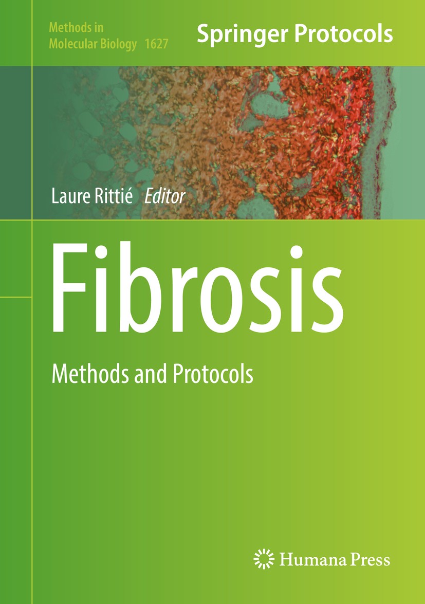 Titlebook: Fibrosis; Methods and Protocol Laure Rittié Book 2017 Springer Science+Business Media LLC 2017 bleomycin.Myocardial infarction.fibroblasts. Titlebook: Fibrosis; Methods and Protocol Laure Rittié Book 2017 Springer Science+Business Media LLC 2017 bleomycin.Myocardial infarction.fibroblasts.