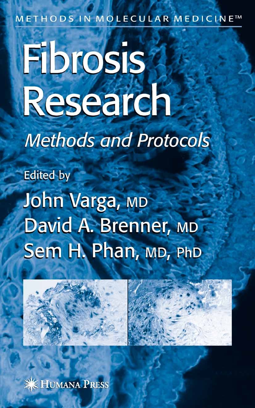 Titlebook: Fibrosis Research; Methods and Protocol John Varga,David A. Brenner,Sem H. Phan Book 2005 Humana Press 2005 biopsy.molecular medicine.patho Titlebook: Fibrosis Research; Methods and Protocol John Varga,David A. Brenner,Sem H. Phan Book 2005 Humana Press 2005 biopsy.molecular medicine.patho