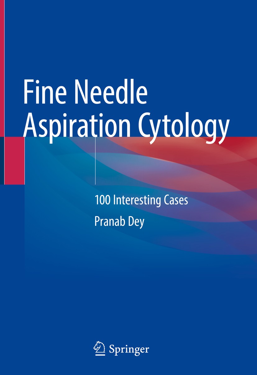 Titlebook: Fine Needle Aspiration Cytology; 100 Interesting Case Pranab Dey Book 2020 Springer Nature Singapore Pte Ltd. 2020 FNAC of head and neck re Titlebook: Fine Needle Aspiration Cytology; 100 Interesting Case Pranab Dey Book 2020 Springer Nature Singapore Pte Ltd. 2020 FNAC of head and neck re