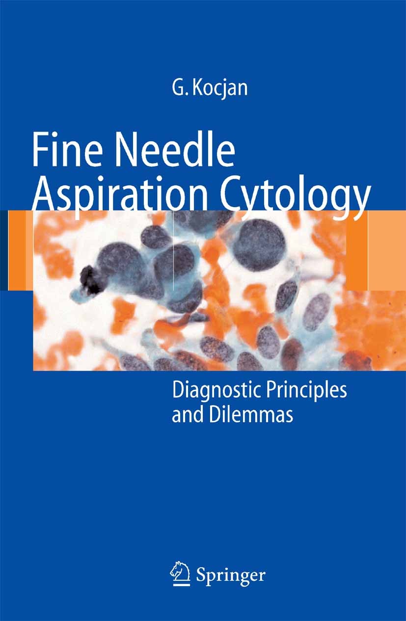 Titlebook: Fine Needle Aspiration Cytology; Diagnostic Principle Gabrijela Kocjan Book 2006 Springer-Verlag Berlin Heidelberg 2006 FNAC.biopsy.cell.cy Titlebook: Fine Needle Aspiration Cytology; Diagnostic Principle Gabrijela Kocjan Book 2006 Springer-Verlag Berlin Heidelberg 2006 FNAC.biopsy.cell.cy