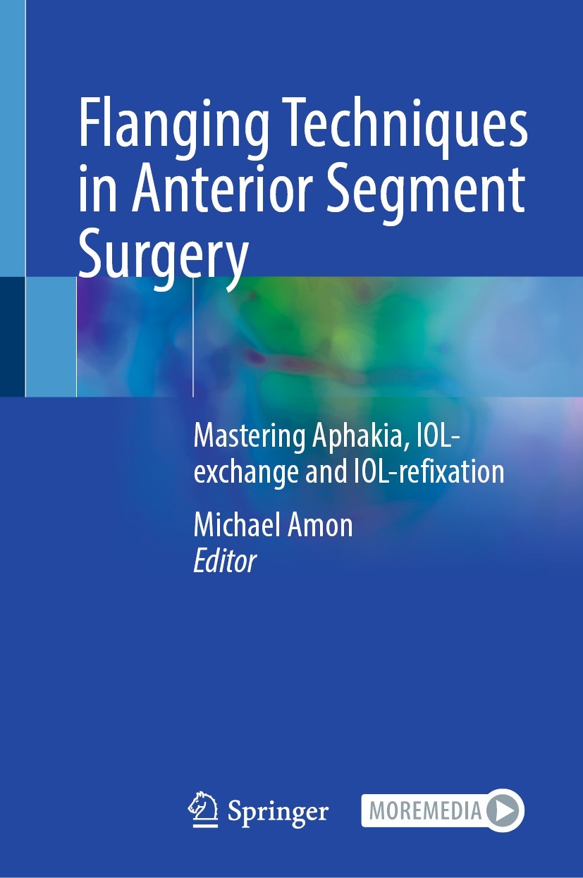 Titlebook: Flanging Techniques in Anterior Segment Surgery; Mastering Aphakia, I Michael Amon Book 2023 The Editor(s) (if applicable) and The Author(s Titlebook: Flanging Techniques in Anterior Segment Surgery; Mastering Aphakia, I Michael Amon Book 2023 The Editor(s) (if applicable) and The Author(s