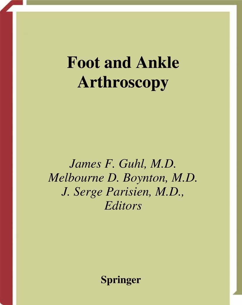 Titlebook: Foot and Ankle Arthroscopy; James F. Guhl (Emeritus Professor of Orthopaedic S Book 2004Latest edition Springer Science+Business Media New Titlebook: Foot and Ankle Arthroscopy; James F. Guhl (Emeritus Professor of Orthopaedic S Book 2004Latest edition Springer Science+Business Media New