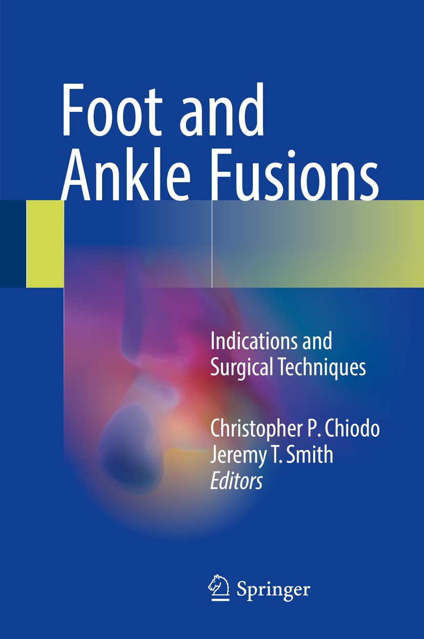 Titlebook: Foot and Ankle Fusions; Indications and Surg Christopher P. Chiodo,Jeremy T. Smith Book 2018 Springer International Publishing AG 2018 Ankl Titlebook: Foot and Ankle Fusions; Indications and Surg Christopher P. Chiodo,Jeremy T. Smith Book 2018 Springer International Publishing AG 2018 Ankl
