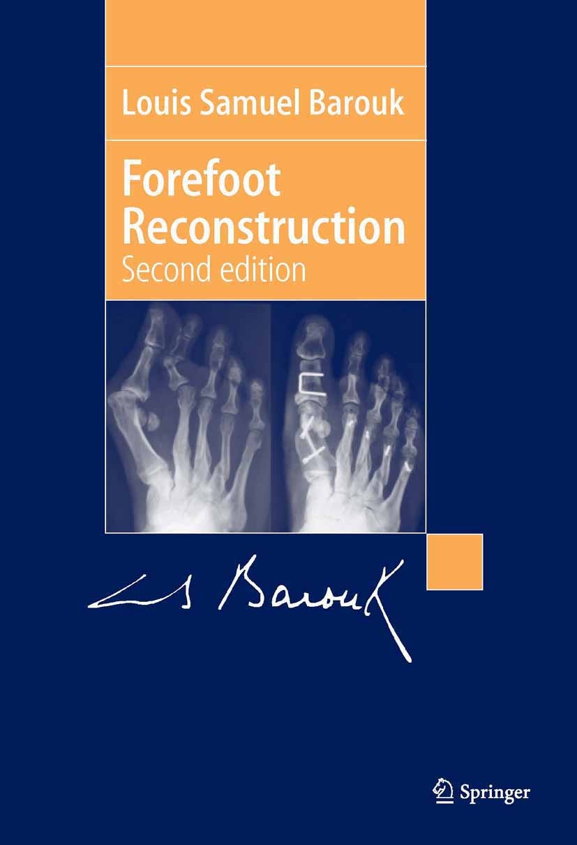 Titlebook: Forefoot Reconstruction; Louis Samuel Barouk Book 2005Latest edition Springer-Verlag Paris 2005 Forefoot.Hallux valgus.Postopearitve manag Titlebook: Forefoot Reconstruction; Louis Samuel Barouk Book 2005Latest edition Springer-Verlag Paris 2005 Forefoot.Hallux valgus.Postopearitve manag