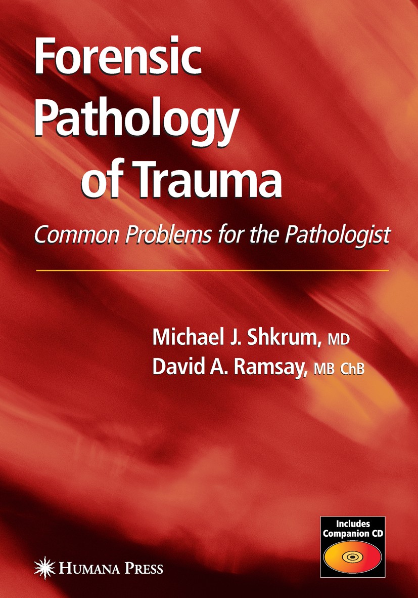 Titlebook: Forensic Pathology of Trauma; Michael J. Shkrum,David A. Ramsay Book 2007 Humana Press 2007 Autopsy.forensic pathology.pathology.trauma Titlebook: Forensic Pathology of Trauma; Michael J. Shkrum,David A. Ramsay Book 2007 Humana Press 2007 Autopsy.forensic pathology.pathology.trauma