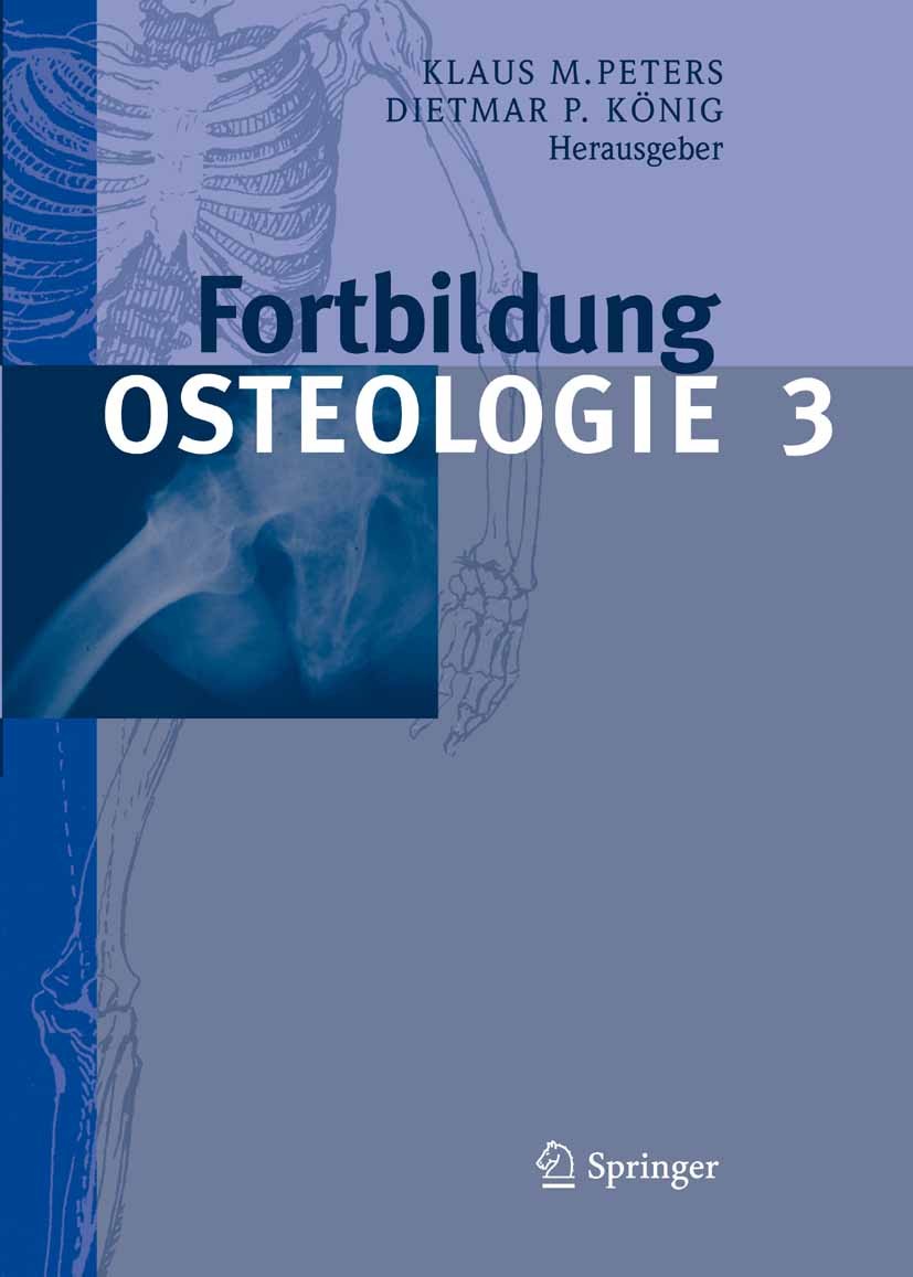 Titlebook: Fortbildung Osteologie 3; Klaus M. Peters,Dietmar P. König Book 2010 Springer-Verlag Berlin Heidelberg 2010 Arthropathie.Arthropathien.Chi Titlebook: Fortbildung Osteologie 3; Klaus M. Peters,Dietmar P. König Book 2010 Springer-Verlag Berlin Heidelberg 2010 Arthropathie.Arthropathien.Chi