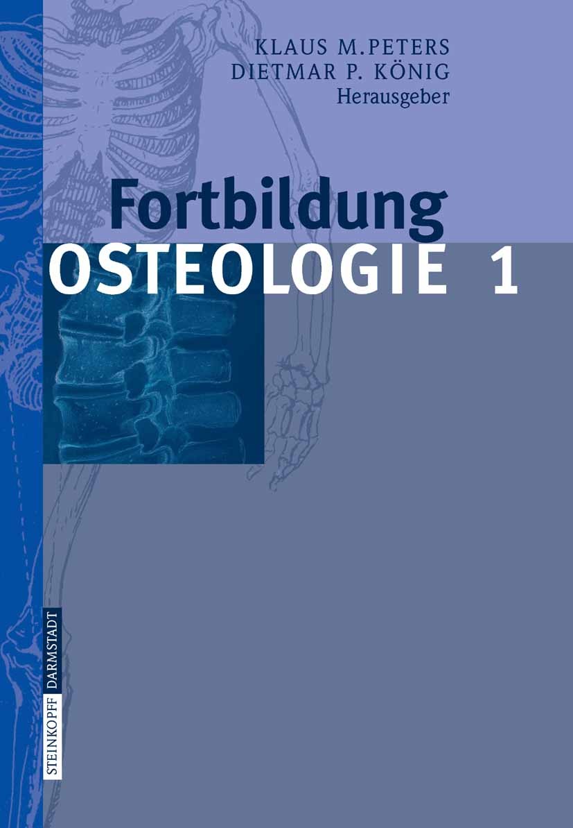 Titlebook: Fortbildung Osteologie 1; Klaus M. Peters,Dietmar P. König Book 2006 Steinkopff-Verlag Darmstadt 2006 Chirurgie.Diagnose.Genetik.Implantat Titlebook: Fortbildung Osteologie 1; Klaus M. Peters,Dietmar P. König Book 2006 Steinkopff-Verlag Darmstadt 2006 Chirurgie.Diagnose.Genetik.Implantat