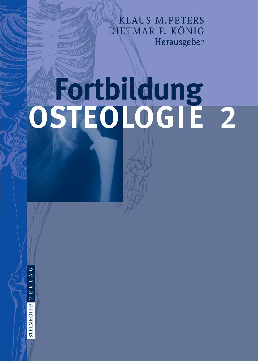 Titlebook: Fortbildung Osteologie 2; Klaus M. Peters,Dietmar P. König Book 2008 Steinkopff-Verlag Darmstadt 2008 Biomechanik.Chemotherapie.Chirurgie. Titlebook: Fortbildung Osteologie 2; Klaus M. Peters,Dietmar P. König Book 2008 Steinkopff-Verlag Darmstadt 2008 Biomechanik.Chemotherapie.Chirurgie.