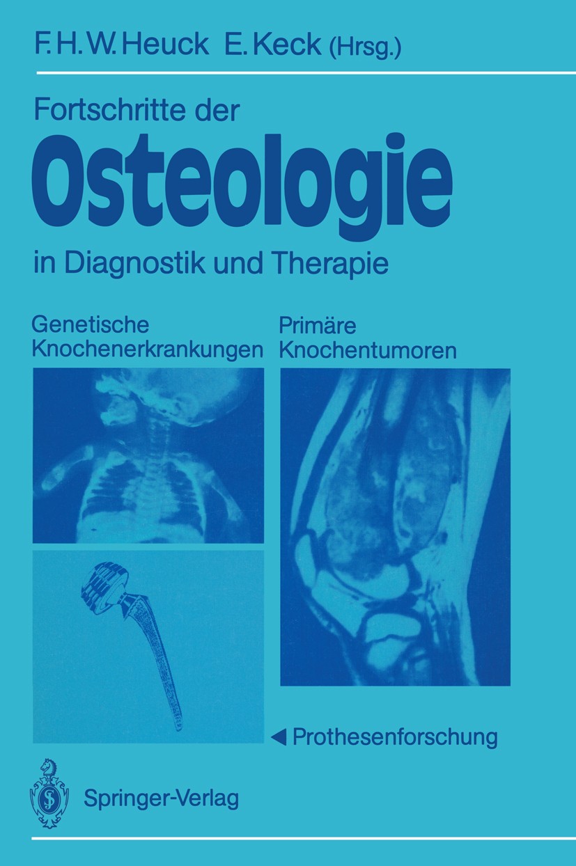 Titlebook: Fortschritte der Osteologie in Diagnostik und Therapie; Genetische Knochener Friedrich H. W. Heuck,Elmar Keck Conference proceedings 1988 S Titlebook: Fortschritte der Osteologie in Diagnostik und Therapie; Genetische Knochener Friedrich H. W. Heuck,Elmar Keck Conference proceedings 1988 S