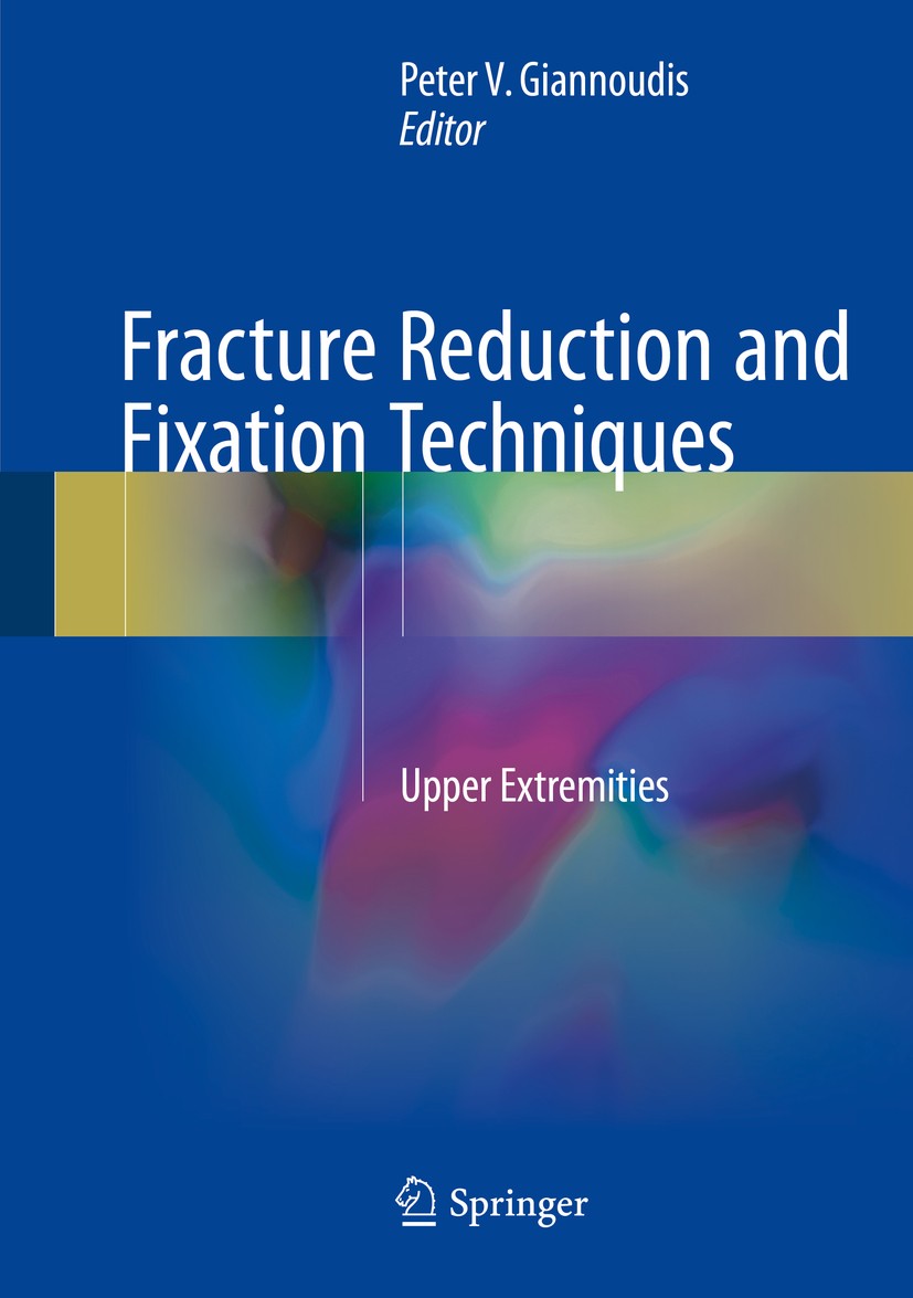 Titlebook: Fracture Reduction and Fixation Techniques; Upper Extremities Peter V. Giannoudis Book 2018 Springer International Publishing AG, part of S Titlebook: Fracture Reduction and Fixation Techniques; Upper Extremities Peter V. Giannoudis Book 2018 Springer International Publishing AG, part of S