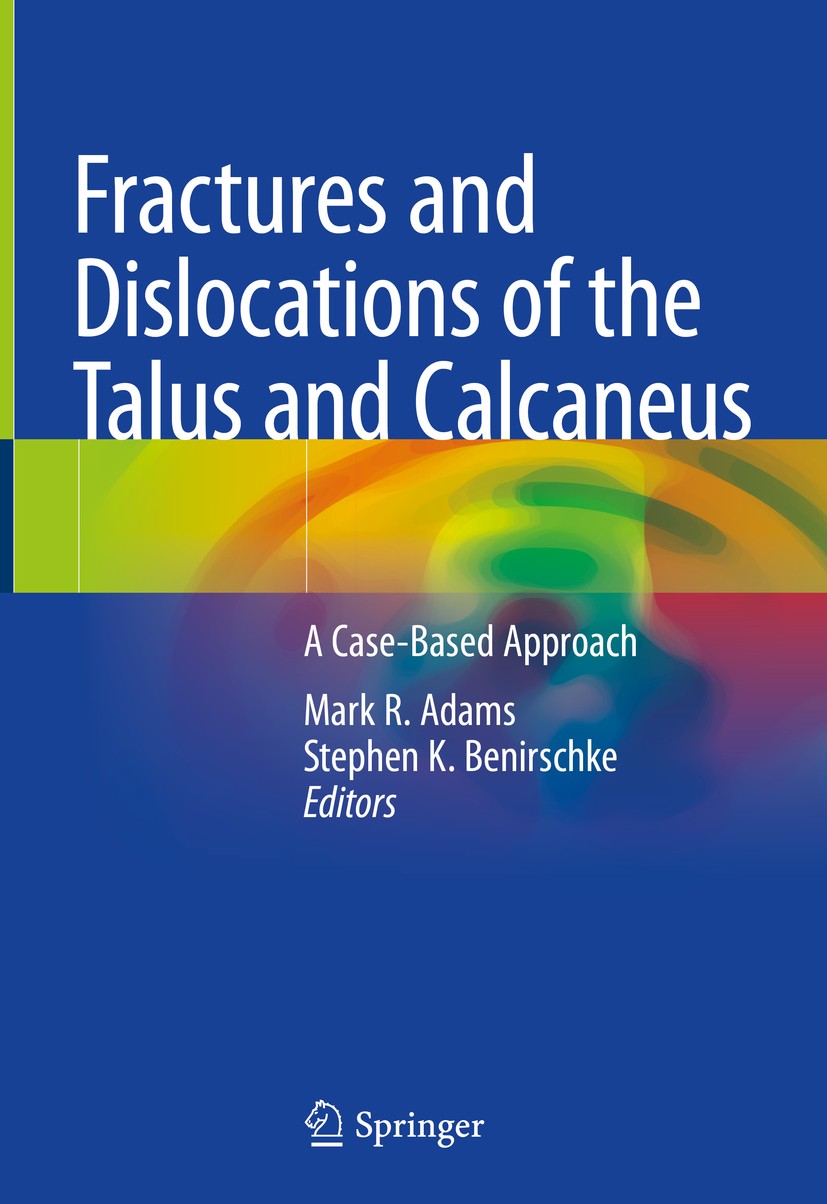 Titlebook: Fractures and Dislocations of the Talus and Calcaneus; A Case-Based Approac Mark R. Adams,Stephen K. Benirschke Book 2020 Springer Nature S Titlebook: Fractures and Dislocations of the Talus and Calcaneus; A Case-Based Approac Mark R. Adams,Stephen K. Benirschke Book 2020 Springer Nature S