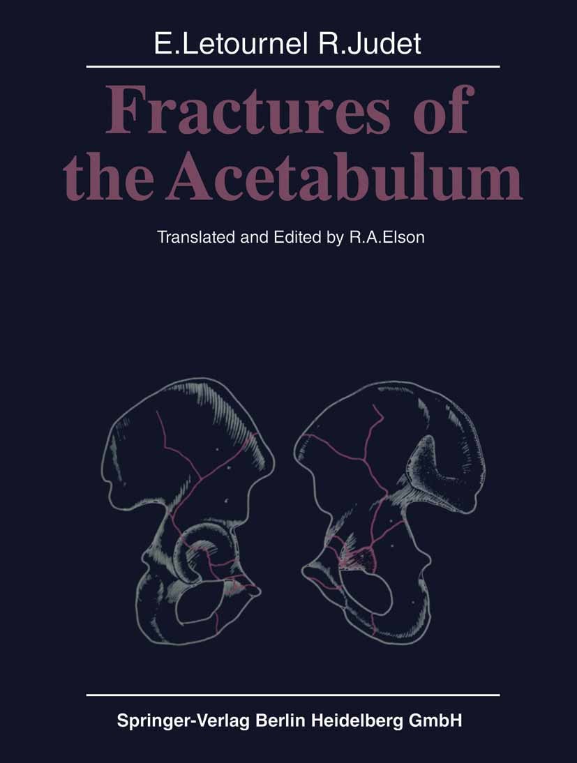 Titlebook: Fractures of the Acetabulum; Emile Letournel,Robert Judet,Reginald A. Elson Book 19811st edition Springer-Verlag Berlin Heidelberg 1981 Ac Titlebook: Fractures of the Acetabulum; Emile Letournel,Robert Judet,Reginald A. Elson Book 19811st edition Springer-Verlag Berlin Heidelberg 1981 Ac