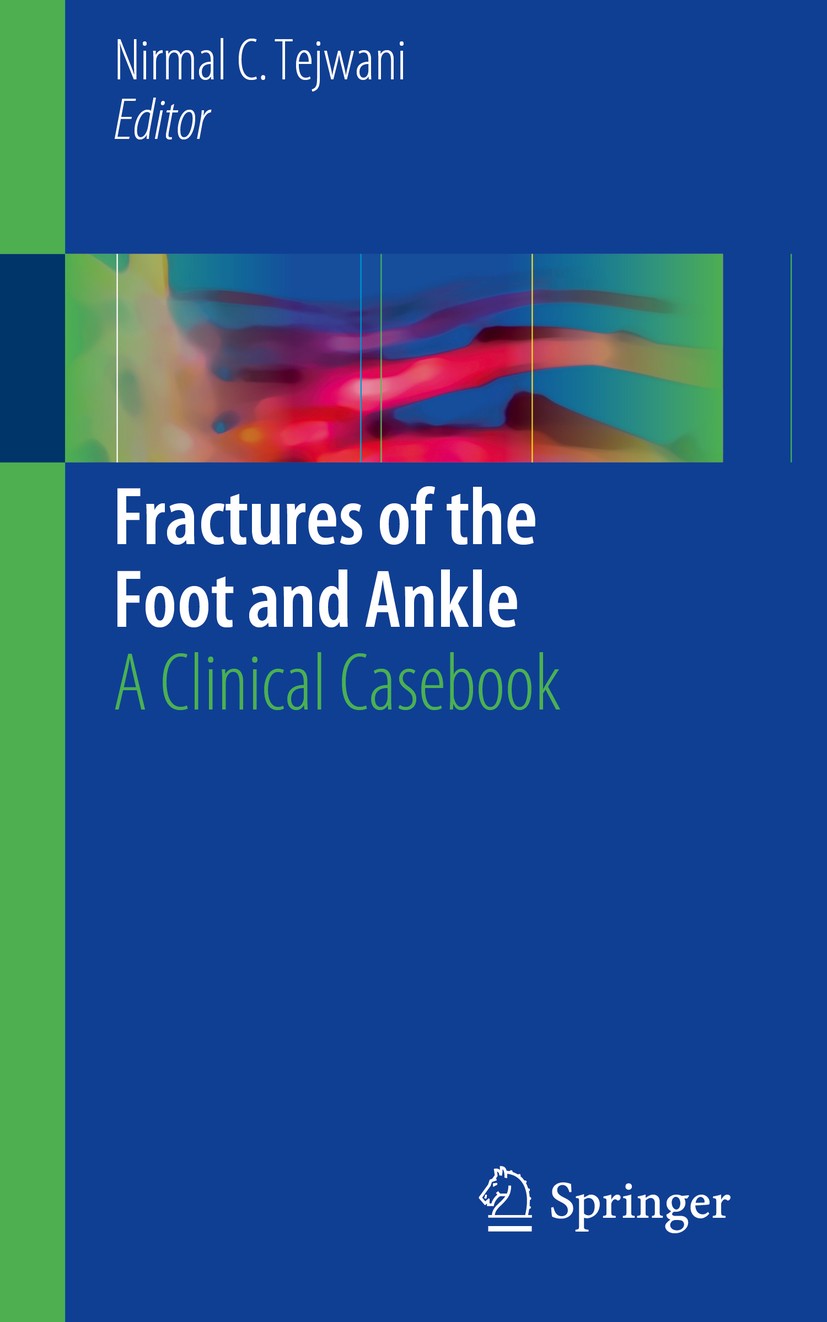 Titlebook: Fractures of the Foot and Ankle; A Clinical Casebook Nirmal C. Tejwani Book 2018 Springer International Publishing AG 2018 Ankle fracture.A Titlebook: Fractures of the Foot and Ankle; A Clinical Casebook Nirmal C. Tejwani Book 2018 Springer International Publishing AG 2018 Ankle fracture.A