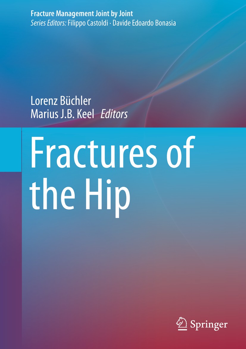 Titlebook: Fractures of the Hip; Lorenz Büchler,Marius J.B. Keel Book 2019 Springer Nature Switzerland AG 2019 Anatomy of the hip.Acetabular fracture Titlebook: Fractures of the Hip; Lorenz Büchler,Marius J.B. Keel Book 2019 Springer Nature Switzerland AG 2019 Anatomy of the hip.Acetabular fracture