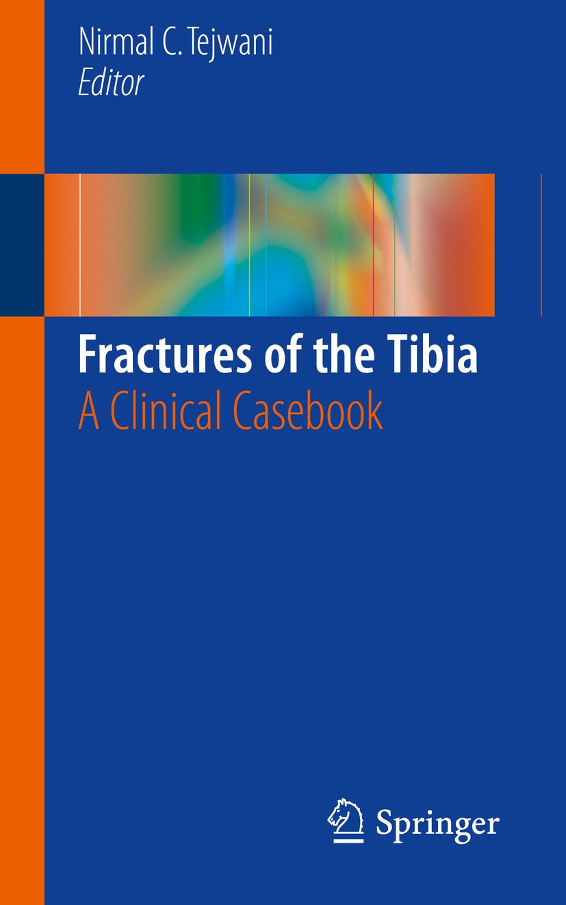 Titlebook: Fractures of the Tibia; A Clinical Casebook Nirmal C. Tejwani Book 2016 Springer International Publishing Switzerland 2016 Bicondylar fract Titlebook: Fractures of the Tibia; A Clinical Casebook Nirmal C. Tejwani Book 2016 Springer International Publishing Switzerland 2016 Bicondylar fract