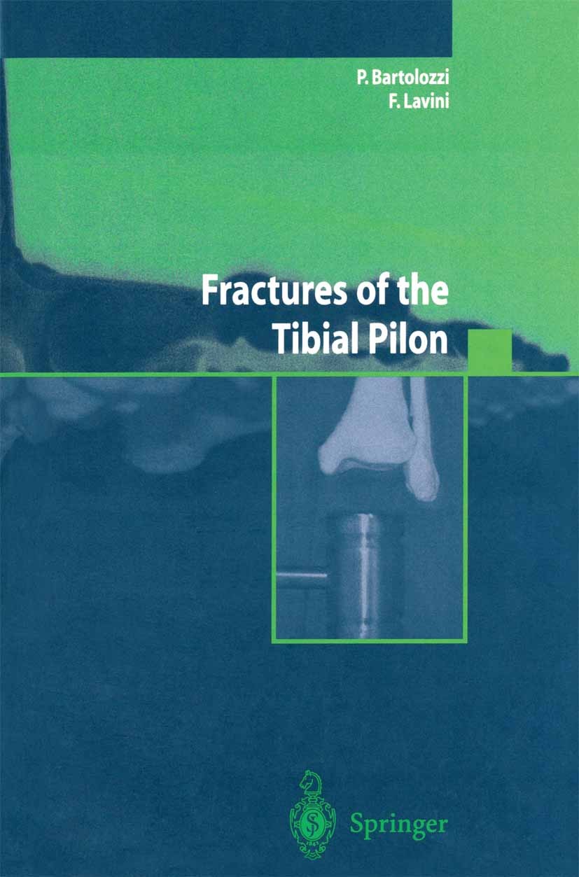 Titlebook: Fractures of the Tibial Pilon; P. Bartolozzi,F. Lavini Book 2004 Springer-Verlag Italia 2004 Fractures treatment.fractures in pediatric ag Titlebook: Fractures of the Tibial Pilon; P. Bartolozzi,F. Lavini Book 2004 Springer-Verlag Italia 2004 Fractures treatment.fractures in pediatric ag