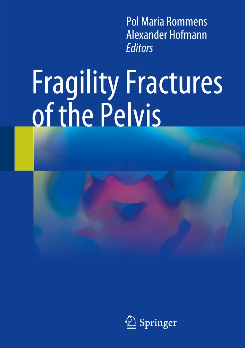 Titlebook: Fragility Fractures of the Pelvis; Pol Maria Rommens,Alexander Hofmann Book 2017 Springer International Publishing AG 2017 Classification. Titlebook: Fragility Fractures of the Pelvis; Pol Maria Rommens,Alexander Hofmann Book 2017 Springer International Publishing AG 2017 Classification.