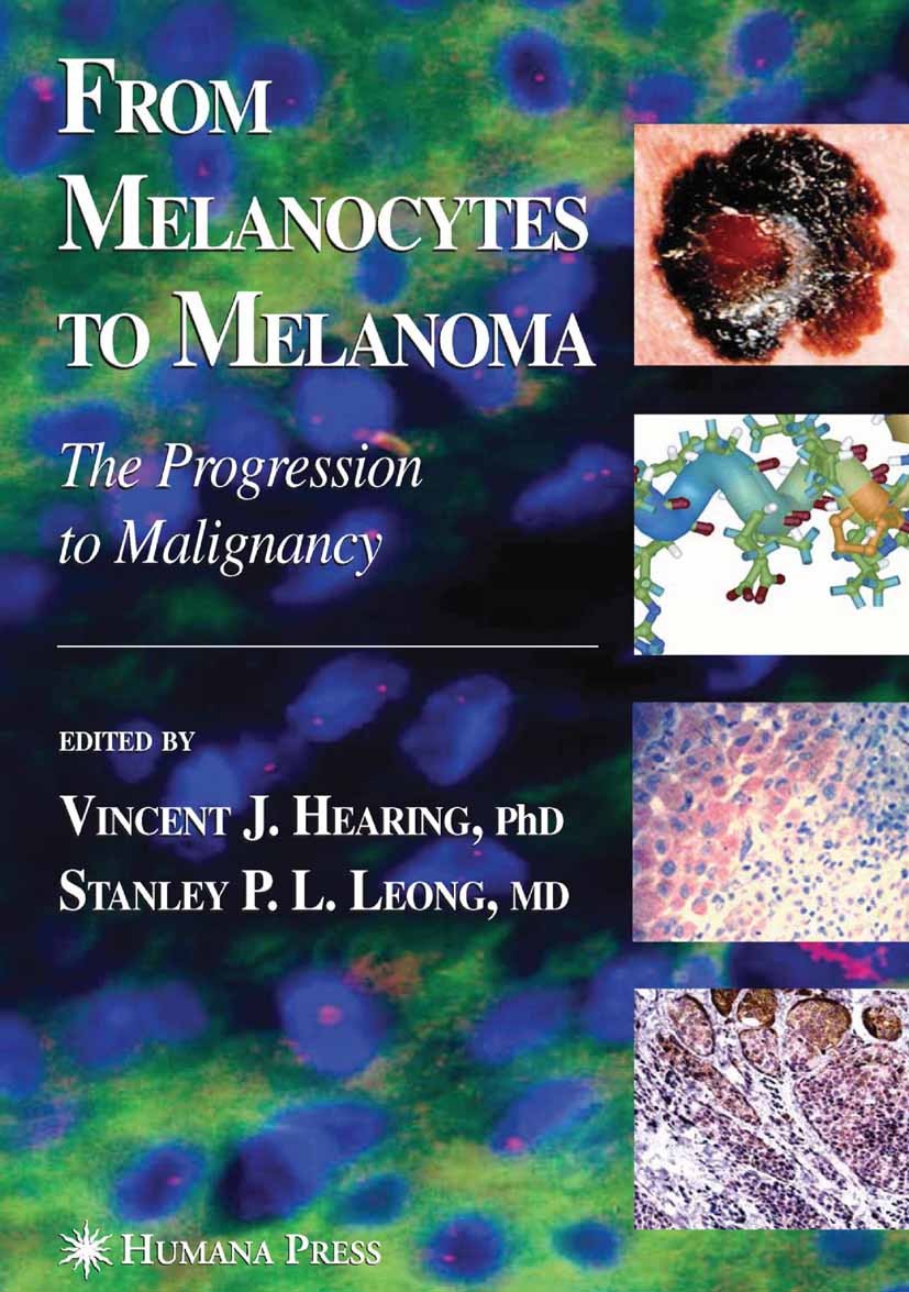 Titlebook: From Melanocytes to Melanoma; The Progression to M Vincent J. Hearing,Stanley P. L. Leong Book 2006 Humana Press 2006 DNA.apoptosis.cancer. Titlebook: From Melanocytes to Melanoma; The Progression to M Vincent J. Hearing,Stanley P. L. Leong Book 2006 Humana Press 2006 DNA.apoptosis.cancer.