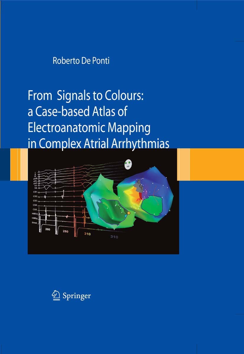 Titlebook: From Signals to Colours; A Case-based Atlas o Roberto Ponti Book 2008 Springer-Verlag Milan 2008 Clinical electrophysiology.catheter ablati Titlebook: From Signals to Colours; A Case-based Atlas o Roberto Ponti Book 2008 Springer-Verlag Milan 2008 Clinical electrophysiology.catheter ablati