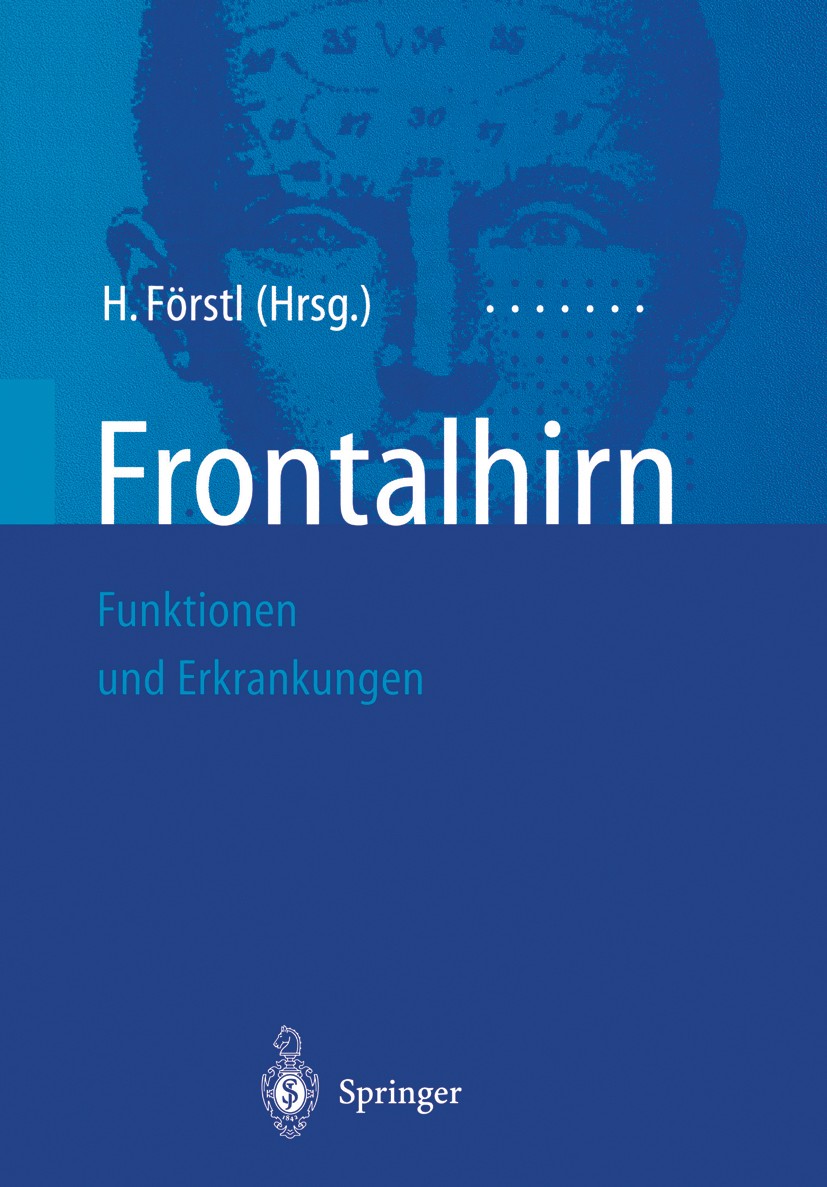 Titlebook: Frontalhirn; Funktionen und Erkra Hans Förstl Book 20021st edition Springer-Verlag Berlin Heidelberg 2002 Affektive Störung.Alkoholabhängig Titlebook: Frontalhirn; Funktionen und Erkra Hans Förstl Book 20021st edition Springer-Verlag Berlin Heidelberg 2002 Affektive Störung.Alkoholabhängig