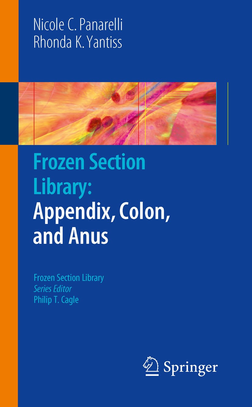 Titlebook: Frozen Section Library: Appendix, Colon, and Anus; Rhonda K. Yantiss,Nicole C. Panarelli Book 2010 Springer-Verlag US 2010 cancer.carcinom Titlebook: Frozen Section Library: Appendix, Colon, and Anus; Rhonda K. Yantiss,Nicole C. Panarelli Book 2010 Springer-Verlag US 2010 cancer.carcinom