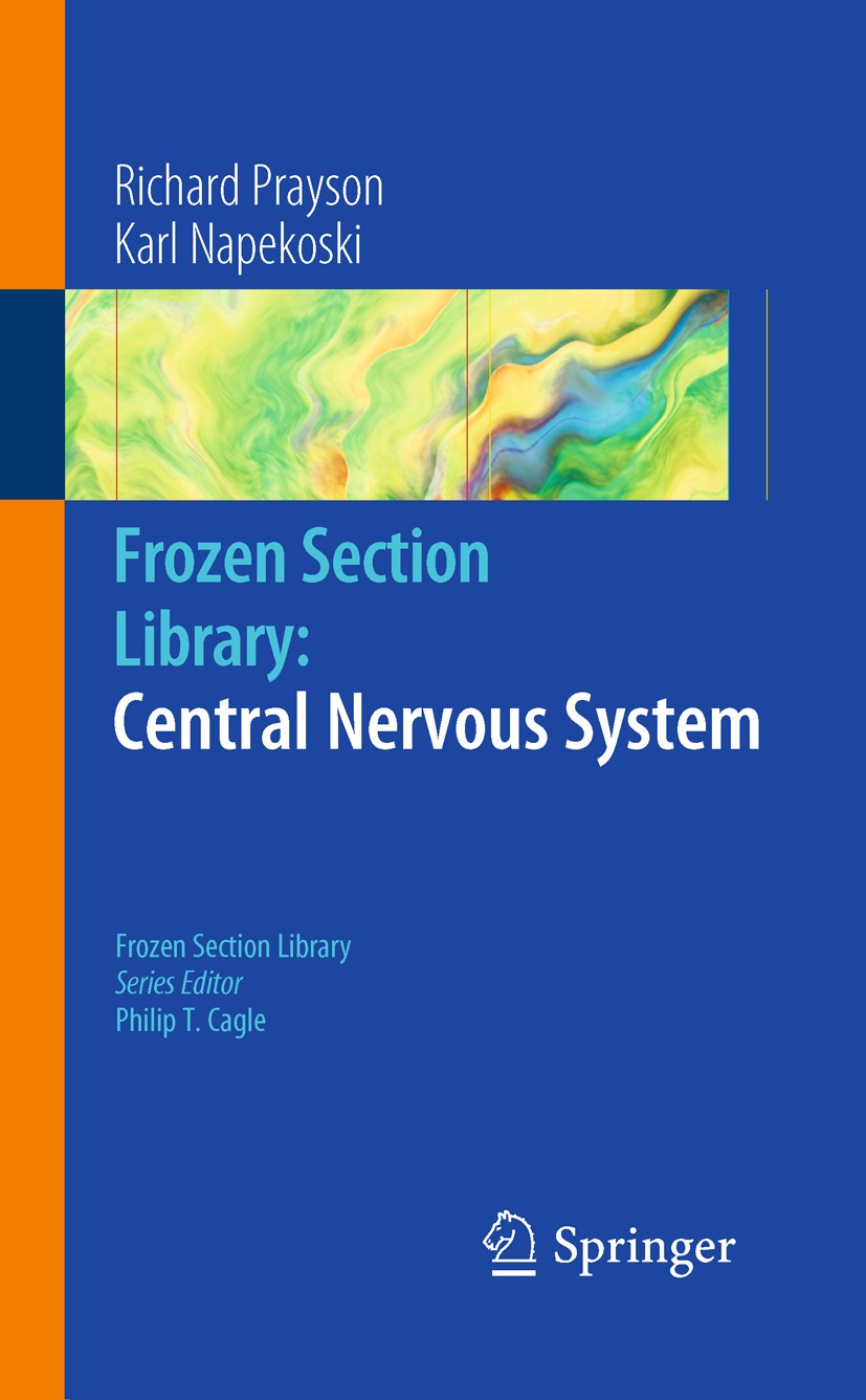 Titlebook: Frozen Section Library: Central Nervous System; Richard A. Prayson,Karl M. Napekoski Book 2011 Springer Science+Business Media, LLC 2011 Titlebook: Frozen Section Library: Central Nervous System; Richard A. Prayson,Karl M. Napekoski Book 2011 Springer Science+Business Media, LLC 2011