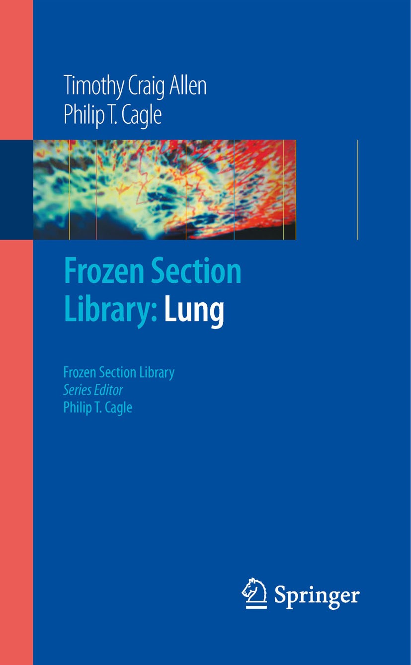 Titlebook: Frozen Section Library: Lung; Timothy Craig Allen,Philip T. Cagle Book 2009 Springer-Verlag New York 2009 Atmen.Lesions.Lymph Nodes.Metast Titlebook: Frozen Section Library: Lung; Timothy Craig Allen,Philip T. Cagle Book 2009 Springer-Verlag New York 2009 Atmen.Lesions.Lymph Nodes.Metast
