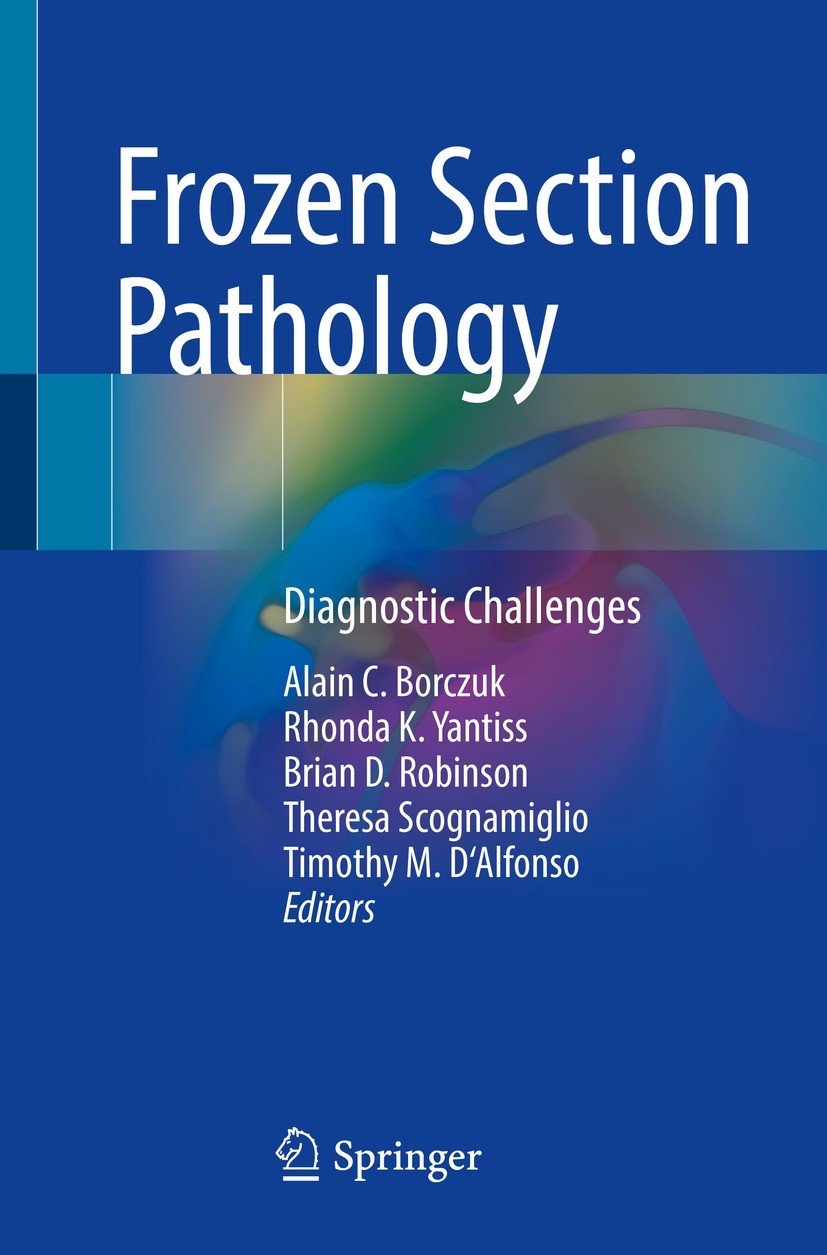 Titlebook: Frozen Section Pathology; Diagnostic Challenge Alain C. Borczuk,Rhonda K. Yantiss,Timothy M. D‘Al Book 2021 Springer Nature Switzerland AG Titlebook: Frozen Section Pathology; Diagnostic Challenge Alain C. Borczuk,Rhonda K. Yantiss,Timothy M. D‘Al Book 2021 Springer Nature Switzerland AG