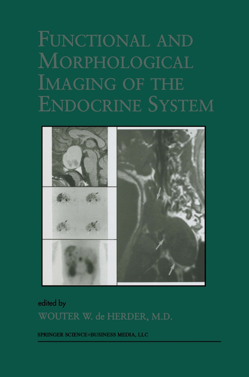 Titlebook: Functional and Morphological Imaging of the Endocrine System; Wouter W. Herder Book 2000 Springer Science+Business Media, LLC, part of Spr Titlebook: Functional and Morphological Imaging of the Endocrine System; Wouter W. Herder Book 2000 Springer Science+Business Media, LLC, part of Spr