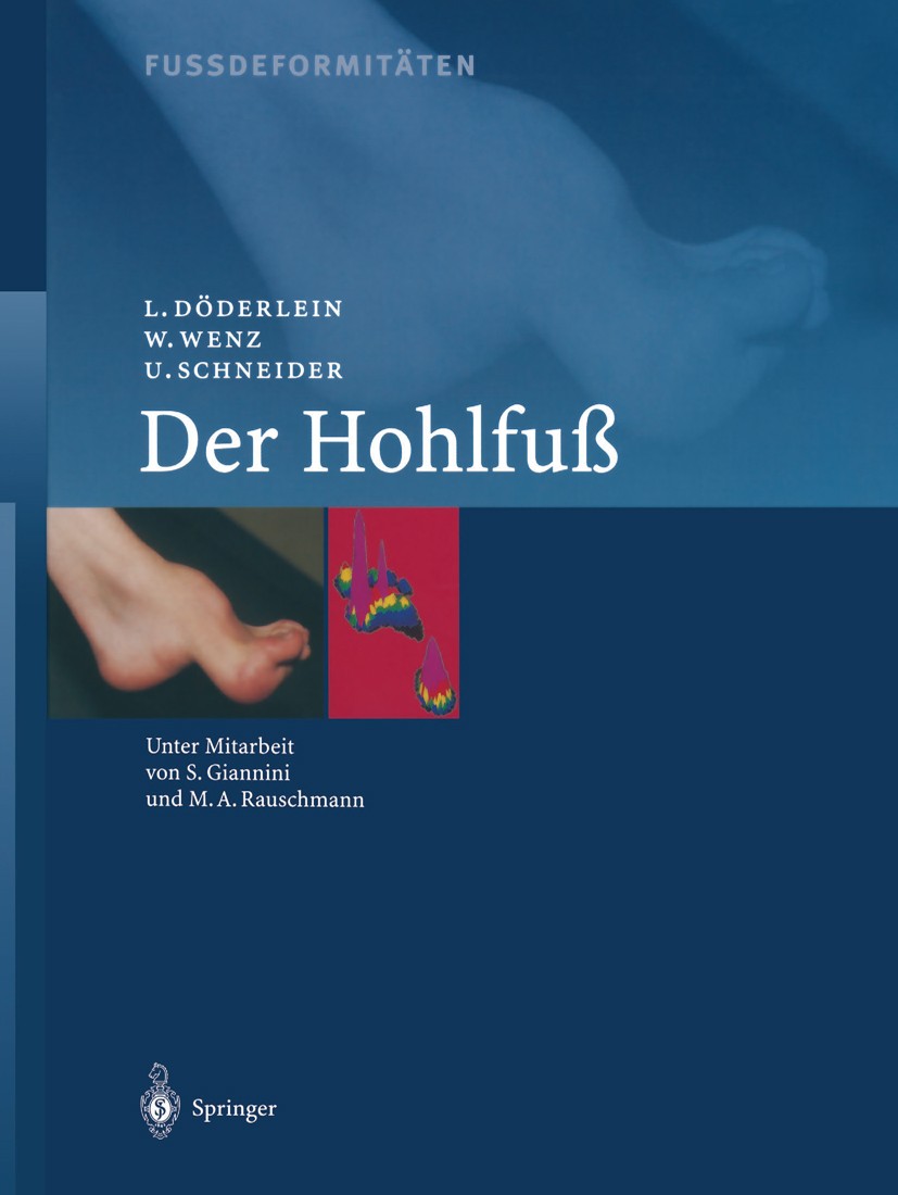 Titlebook: Fussdeformitäten; Der Hohlfuss Leonhard Döderlein,Wolfram Wenz,Urs Schneider Book 2001 Springer-Verlag Berlin Heidelberg 2001 Fußdeformität Titlebook: Fussdeformitäten; Der Hohlfuss Leonhard Döderlein,Wolfram Wenz,Urs Schneider Book 2001 Springer-Verlag Berlin Heidelberg 2001 Fußdeformität
