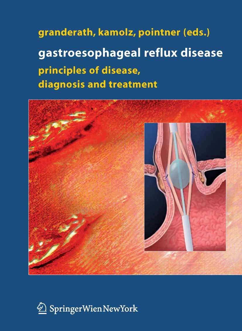 Titlebook: Gastroesophageal Reflux Disease; Principles of Diseas Frank A. Granderath,Thomas Kamolz,Rudolph Pointner Book 2006 Springer-Verlag Vienna 2 Titlebook: Gastroesophageal Reflux Disease; Principles of Diseas Frank A. Granderath,Thomas Kamolz,Rudolph Pointner Book 2006 Springer-Verlag Vienna 2