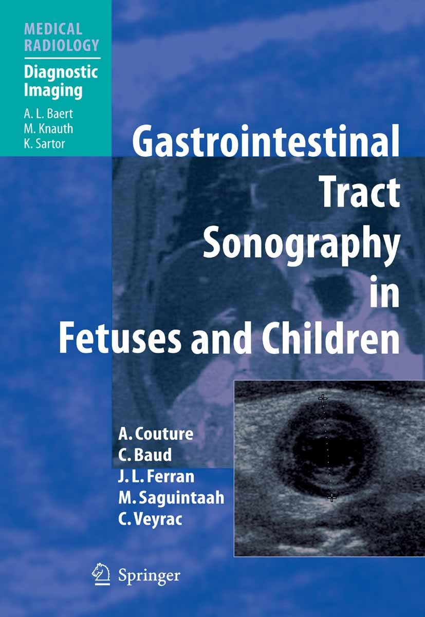 Titlebook: Gastrointestinal Tract Sonography in Fetuses and Children; Alain Couture,Catherine Baud,Corinne Veyrac Book 2008 Springer-Verlag Berlin He Titlebook: Gastrointestinal Tract Sonography in Fetuses and Children; Alain Couture,Catherine Baud,Corinne Veyrac Book 2008 Springer-Verlag Berlin He