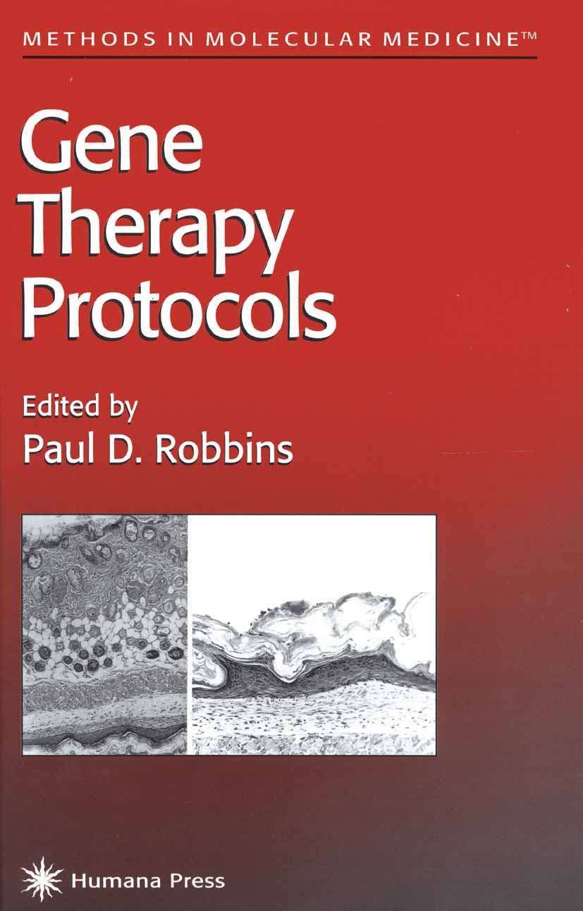 Titlebook: Gene Therapy Protocols; Paul D. Robbins Book 19971st edition Springer Science+Business Media New York 1997 Titlebook: Gene Therapy Protocols; Paul D. Robbins Book 19971st edition Springer Science+Business Media New York 1997