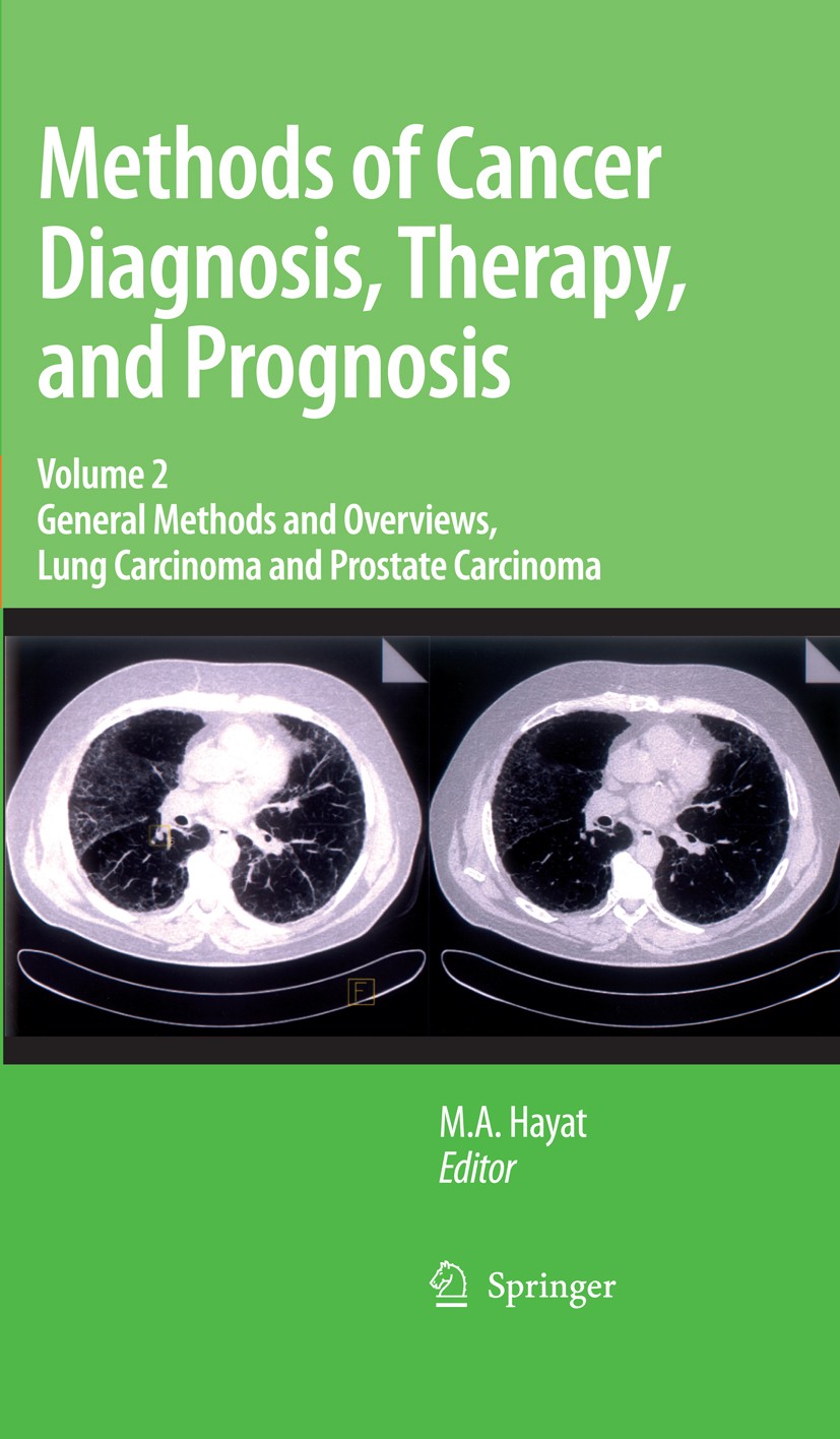 Titlebook: Methods of Cancer Diagnosis, Therapy and Prognosis; General Methods and M. A. Hayat Book 2008 Springer Science+Business Media B.V. 2008 Kr Titlebook: Methods of Cancer Diagnosis, Therapy and Prognosis; General Methods and M. A. Hayat Book 2008 Springer Science+Business Media B.V. 2008 Kr