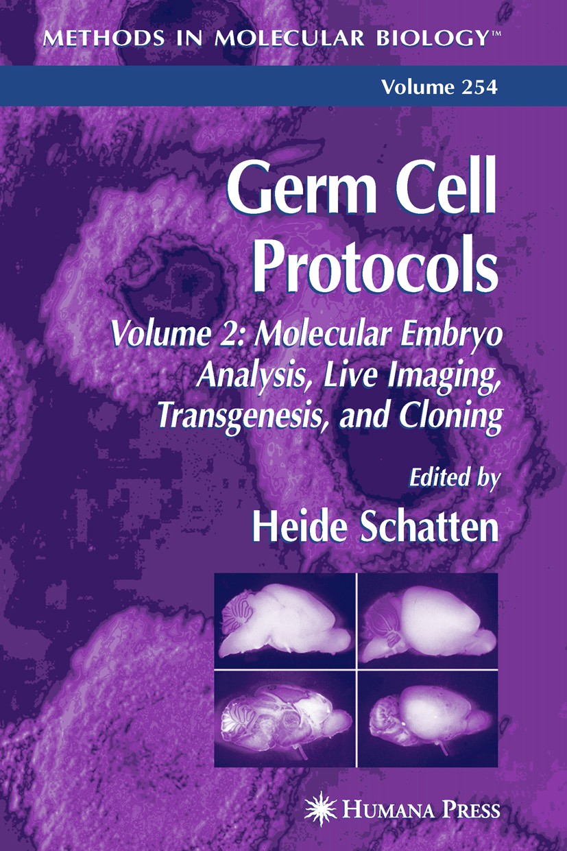 Titlebook: Germ Cell Protocols; Volume 2: Molecular Heide Schatten Book 2004 Humana Press 2004 Titlebook: Germ Cell Protocols; Volume 2: Molecular Heide Schatten Book 2004 Humana Press 2004