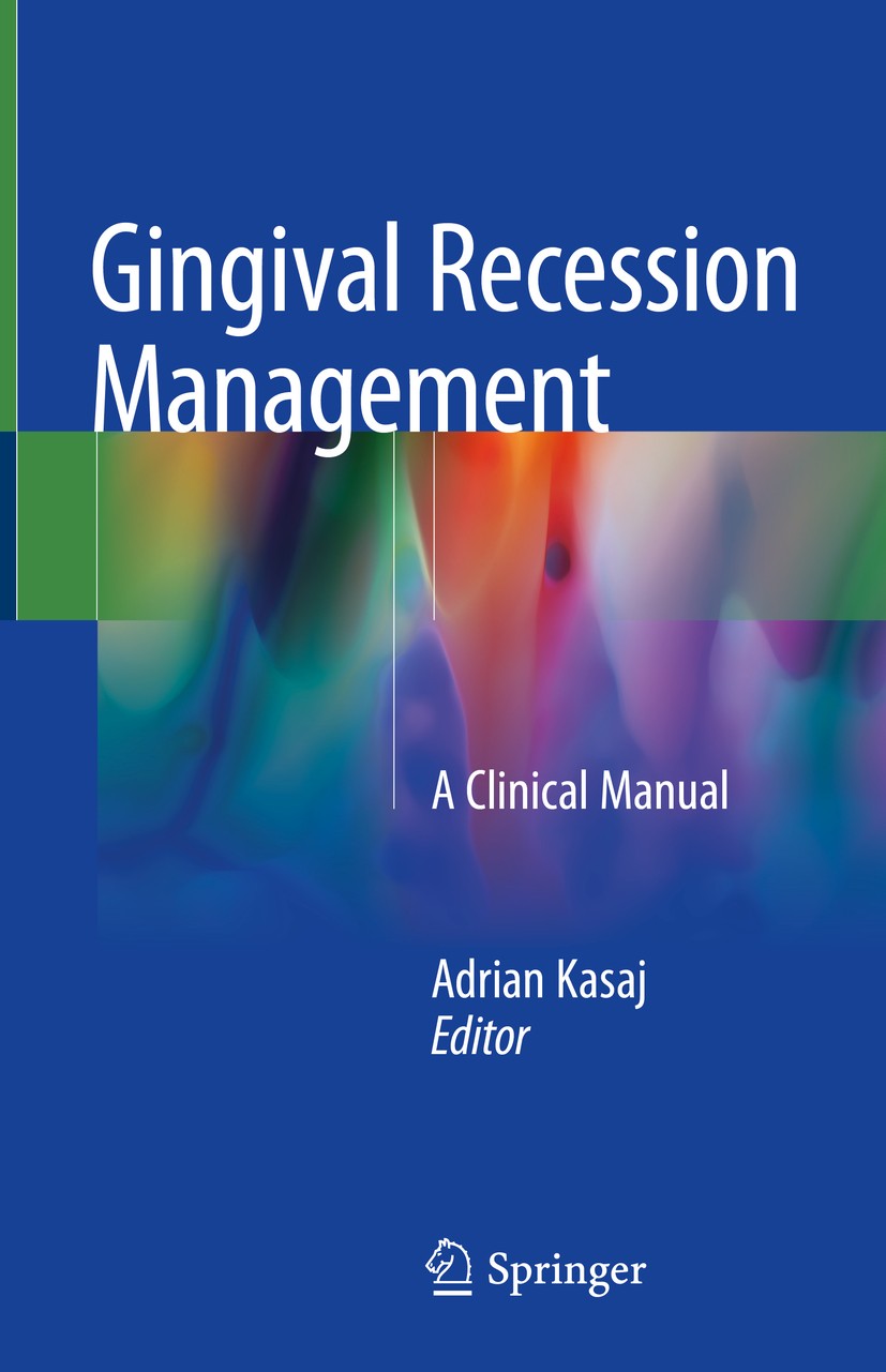 Titlebook: Gingival Recession Management; A Clinical Manual Adrian Kasaj Book 2018 Springer International Publishing AG, part of Springer Nature 2018 Titlebook: Gingival Recession Management; A Clinical Manual Adrian Kasaj Book 2018 Springer International Publishing AG, part of Springer Nature 2018